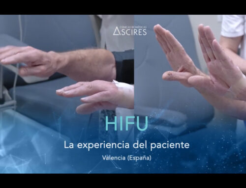 HIFU y párkinson / Vídeo Testimonial