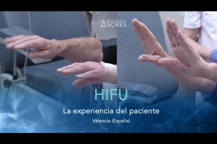 HIFU y párkinson / Vídeo testimonial